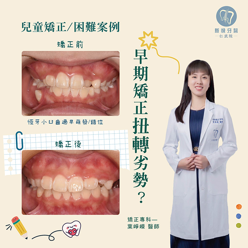 新悅美學牙醫診所的案例分享圖片
